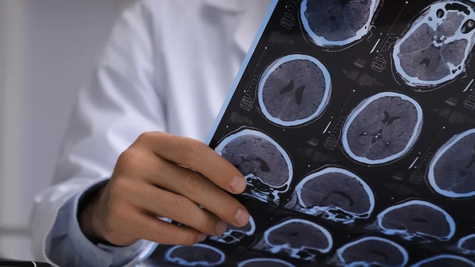 Doctors Suspect Brain Cancer, Discover Live Tapeworms in Man's Brain
